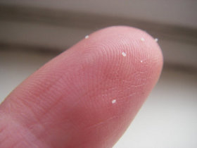 flea eggs on human finger